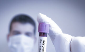 נגיף הקורונה – עדכון פעילות.